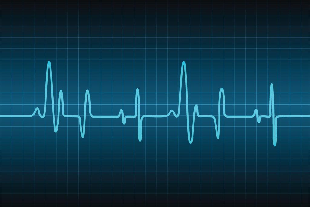 Heart Beats and Beats: The Pulse of Music in Cardio Boosts Heart Beats and Beats: The Pulse of Music in Cardio Boosts
